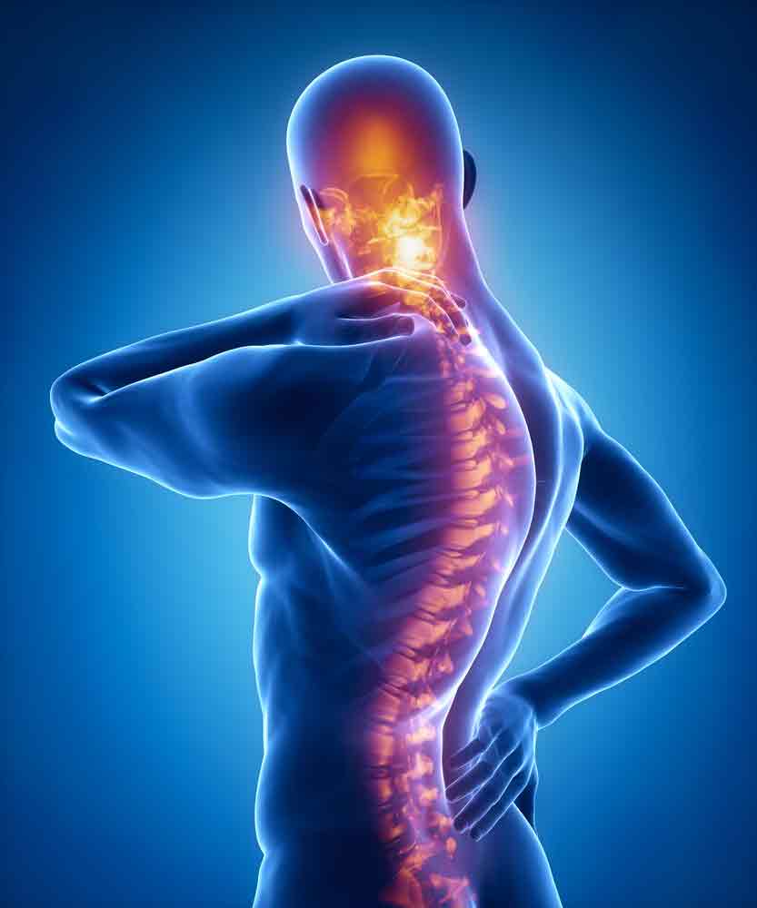 Facet Joint Pain neck back pain oakland physical therapy SOL 409424113 1 Facet Joint Pain
