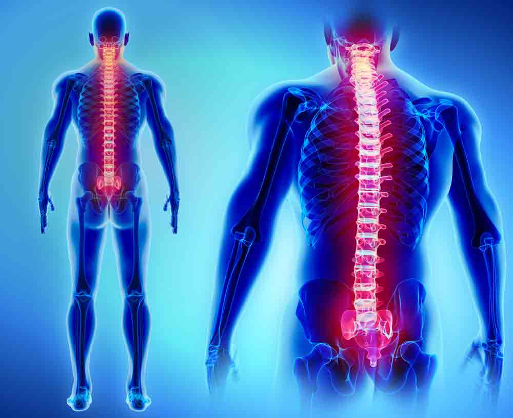 Are you suffering with back pain? spine back pain oakland physical therapy SOL 718049254 1 Are you suffering with back pain?