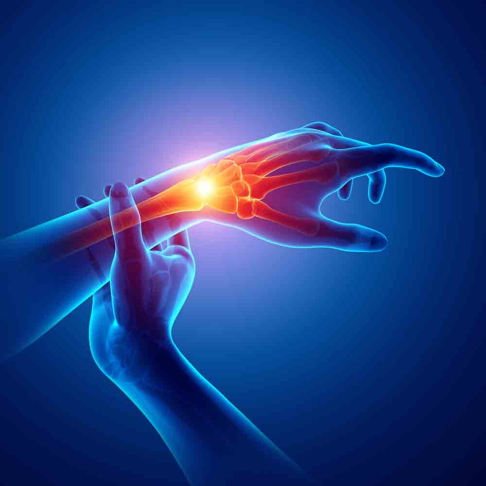 Effective Treatments for Carpal Tunnel and Repetitive Stress Injuries wrist pain oakland physical therapy SOL 603088835 1 Effective Treatments for Carpal Tunnel and Repetitive Stress Injuries