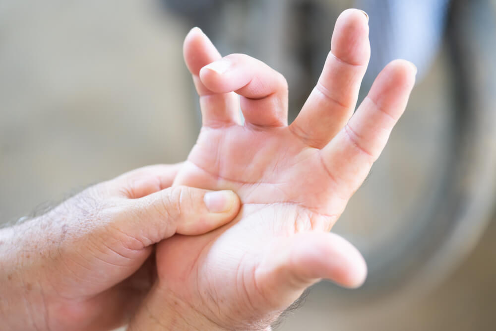 FAQs about Dupuytren's Disease and Contracture Bent Fingers | Renaissance  School of Medicine at Stony Brook University