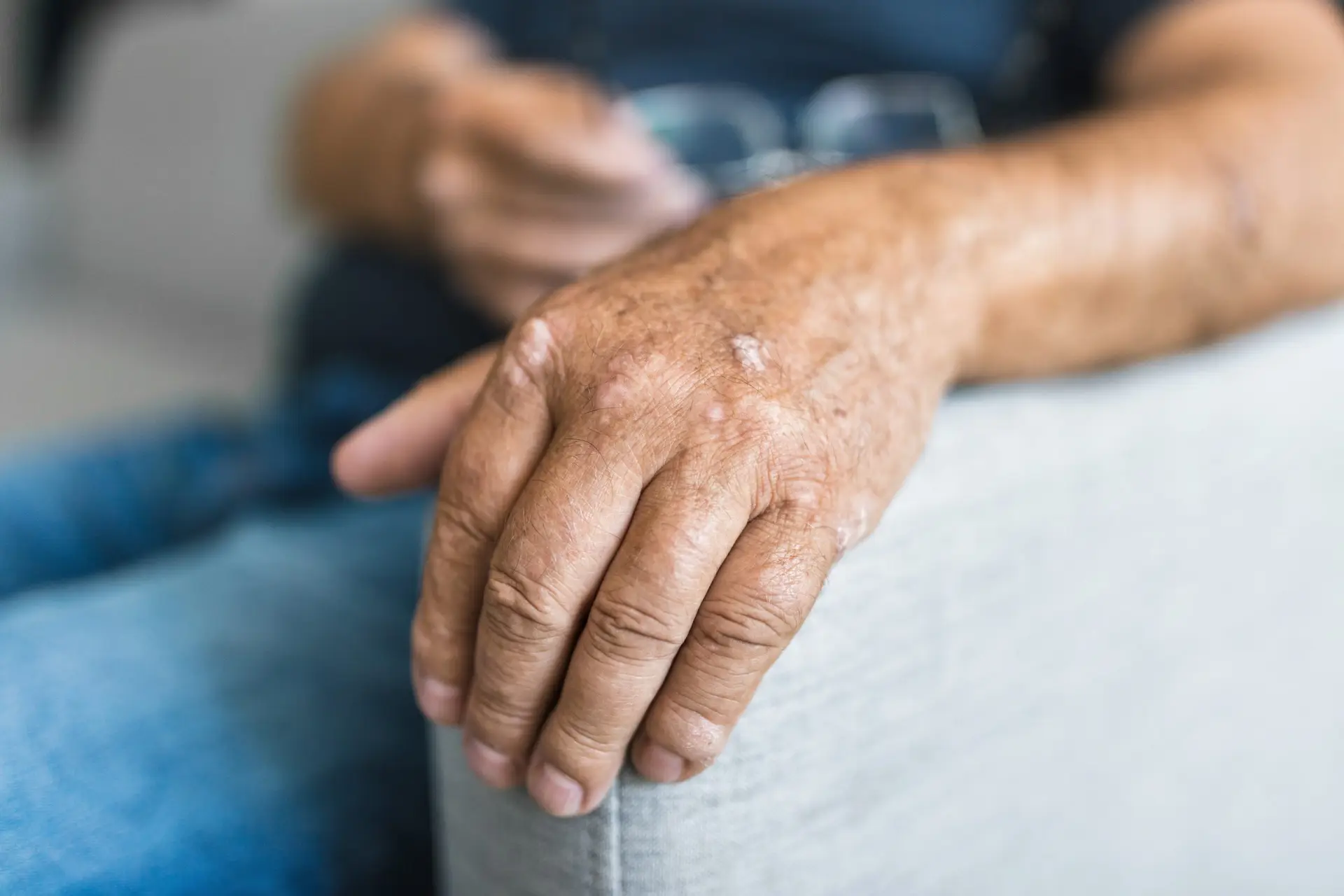 Physical Therapy for Every Type of Arthritis AdobeStock 511026677 scaled Physical Therapy for Every Type of Arthritis